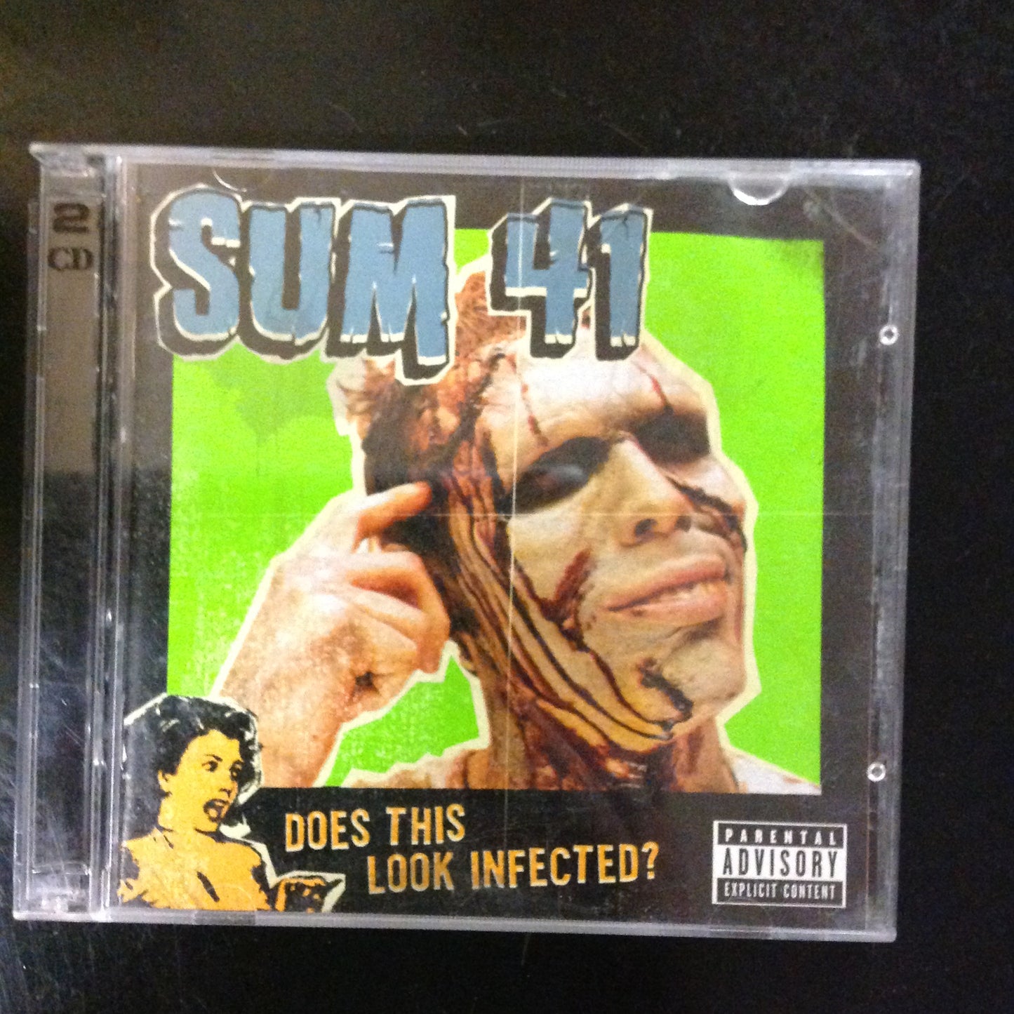 Sum 41 - Does This Look Infected *Single 186